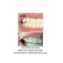 Youngsville Dental Care