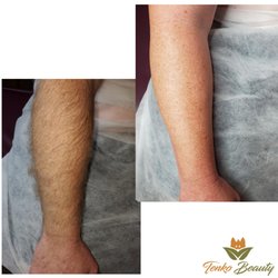 Tenko Beauty - Arm Wax