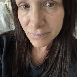 K Cary Canoun, M.D., F.A.C.S - Post op