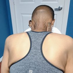 Alcocer Acupuncture Medical Clinic