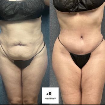 Surface 360 - Cosmetic Surgeons Near Me - Southlake, Texas