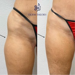 Skin Theory