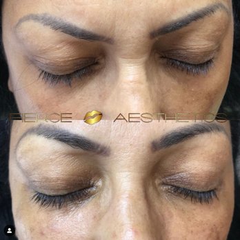 Fierce Aesthetics - Medical Spas Near Me - Stoughton, Massachusetts Fierce Aesthetics - Medical Spas Near Me - Stoughton, Massachusetts