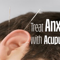 Longevity Acupuncture