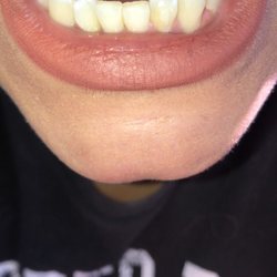 Pickerington Family Dental