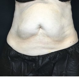 Before taken August 2019 Before taken August 2019