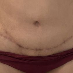 Evoclinic - It shows you I'm non-symmetrical