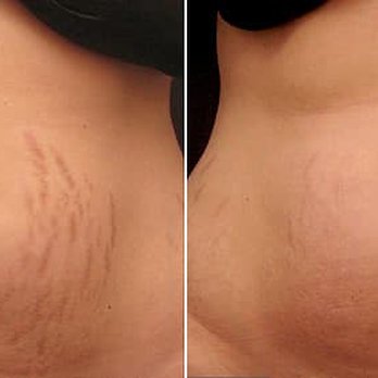 BronzedBrows - Permanent Makeup Near Me - El Segundo, California BronzedBrows - Permanent Makeup Near Me - El Segundo, California
