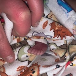 TMC Obstetrics - My sons tiny feet!
