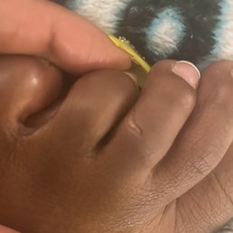 He cut my toe from being so rough . I don't know how he cut it like this .. He cut my toe from being so rough . I don't know how he cut it like this ..