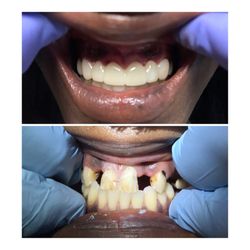 Eagle Dental Center, General & Implant Dentistry