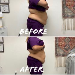 A Slimmer You - This is the before and after starting, so this is my first session. I'm here at my second session will upload a second one