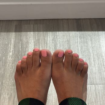 Tips Toes Nail Studio - Ingrown nails were hurting she fixed it. - Nail Salons Near Me - Santa Monica, California Tips Toes Nail Studio - Ingrown nails were hurting she fixed it. - Nail Salons Near Me - Santa Monica, California