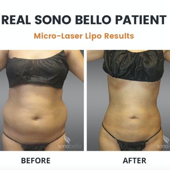 Sono Bello - Cosmetic Surgeons Near Me - Woburn, Massachusetts Sono Bello - Cosmetic Surgeons Near Me - Woburn, Massachusetts