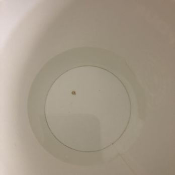 Hilton Knoxville - Bacterial buildup from coffee maker - Hotels Near Me - Knoxville, Tennessee Hilton Knoxville - Bacterial buildup from coffee maker - Hotels Near Me - Knoxville, Tennessee