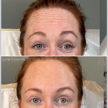 Rodelyn Medical Aesthetics - Medical Spas Near Me - Irvington, New York Rodelyn Medical Aesthetics - Medical Spas Near Me - Irvington, New York