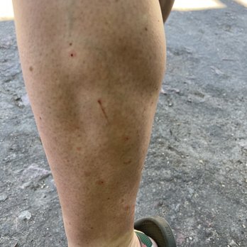 Zoologico De Vallarta - Bug bites. Gnats or chiggers - Zoos Near Me - Boca de Mixmaloya, JAL