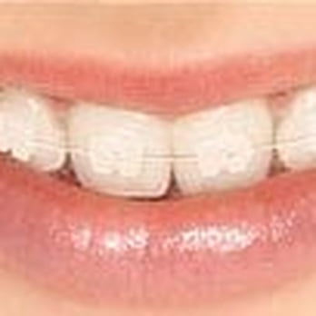 Cory J Costanzo, DDS - We offer cosmetic braces for the image conscious. - Orthodontists Near Me - Fresno, California Cory J Costanzo, DDS - We offer cosmetic braces for the image conscious. - Orthodontists Near Me - Fresno, California