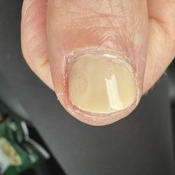 2nd thumb