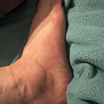 Angel Nails - Right foot red with scratches. - Nail Salons Near Me - Grand Rapids, Michigan Angel Nails - Right foot red with scratches. - Nail Salons Near Me - Grand Rapids, Michigan