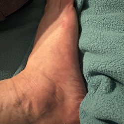 Angel Nails - Right foot red with scratches.