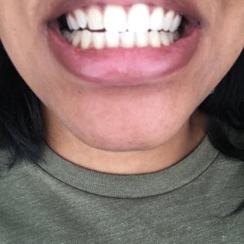 Jenkins Eleonora DMD - After my teeth cleaning! My teeth look good and feel great. - General Dentistry Near Me - Hephzibah, Georgia Jenkins Eleonora DMD - After my teeth cleaning! My teeth look good and feel great. - General Dentistry Near Me - Hephzibah, Georgia