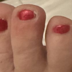 Q Nails and Spa - Toenail infection 2 days post pedicure