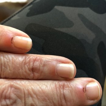 Tulips Nail Spa - Here are my fingers 3 days later... - Nail Salons Near Me - Wilton, Connecticut