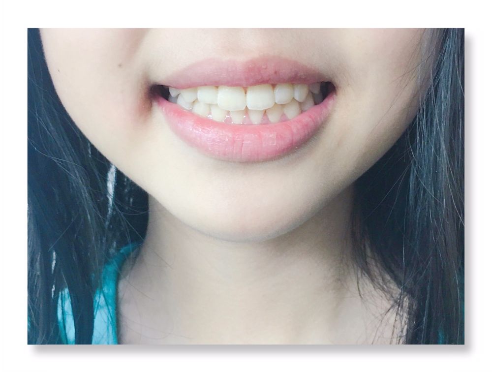 MANOA DENTAL Updated June 2024 15 Photos 829 Isenberg St