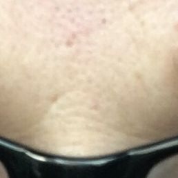 I forgot to post a picture yesterday(1-5-17)!I have some hairy eyebrows but this is the best they've looked!