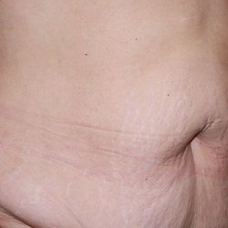 Zieg Plastic Surgery Center