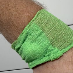 Maryland Primary Care Physicians - Pasadena - Had blood drawn for tests.Green on the right arm. Nautically correct starboard;-)