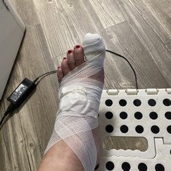 Kitty Nails - Post ingrown removal.