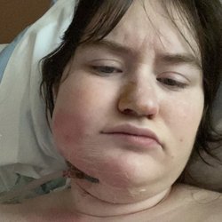 Yen Oral Surgery