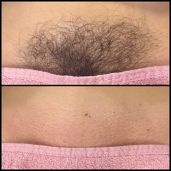 Kay's Esthetics - Brazilian wax