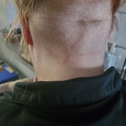 Cuts