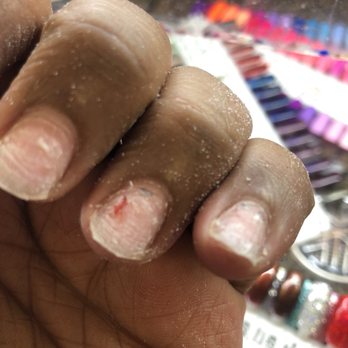 Be Be Nails & Permanent Makeup - May not seem like much, but this hurts even now. A week after. - Nail Salons Near Me - Modesto, California Be Be Nails & Permanent Makeup - May not seem like much, but this hurts even now. A week after. - Nail Salons Near Me - Modesto, California