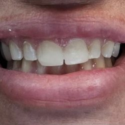 All About Dental Care - after