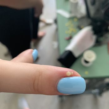 iNail Spa - Draining the infection - Nail Salons Near Me - Vancouver, British Columbia