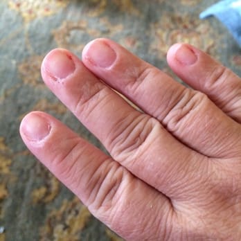 Tricycle Nails - Bleeding cuticles, damaged nails, all the work of Tricycle Nails. - Nail Salons Near Me - Arlington, Washington