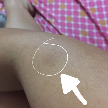 Photo of Harmony Spa of Monterey Park - Monterey Park, CA, United States. FOUR days later and I can still see some bruising from her finger jab. Tsk tsk.
