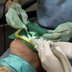 Atlanta Endodontics