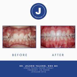Jelson Yalung DDS,MS