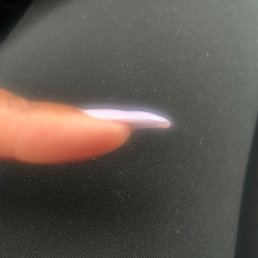 Dented in middle of nail from electric filing. Dented in middle of nail from electric filing.