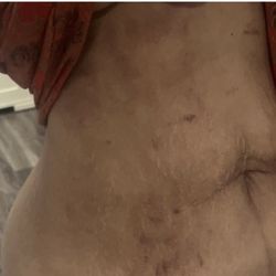 Skinsations