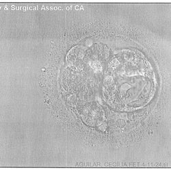 Fertility & Surgical Associates of California - After our transfer.