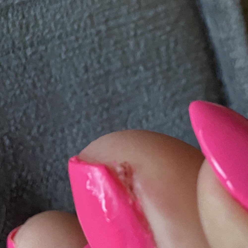 Nail Fever - Nail tech cut my toe. - Nail Salons Near Me - Antioch, California