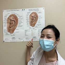 Alhambra Medical University Integrative Clinic - Crystal showing the ear points