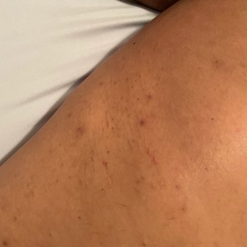 European Wax Center - Upper thigh - Waxing Near Me - Merrick, New York