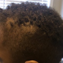 Patches and uneven fade Patches and uneven fade